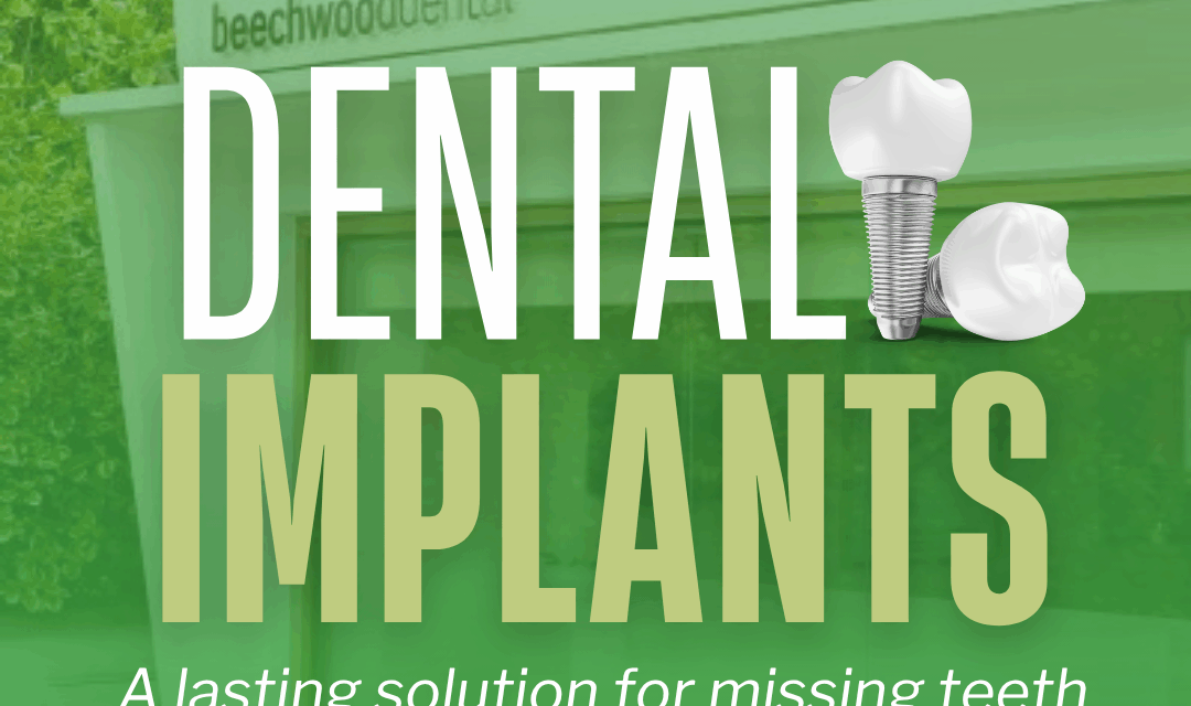 Dental Implants - Beechwood Dental Implants