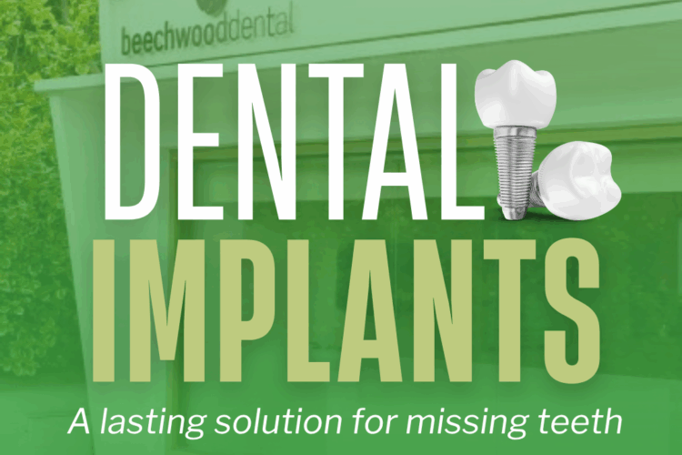 Dental Implants - Beechwood Dental Implants
