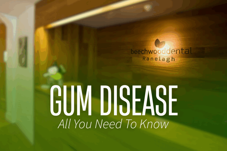 Gum Disease